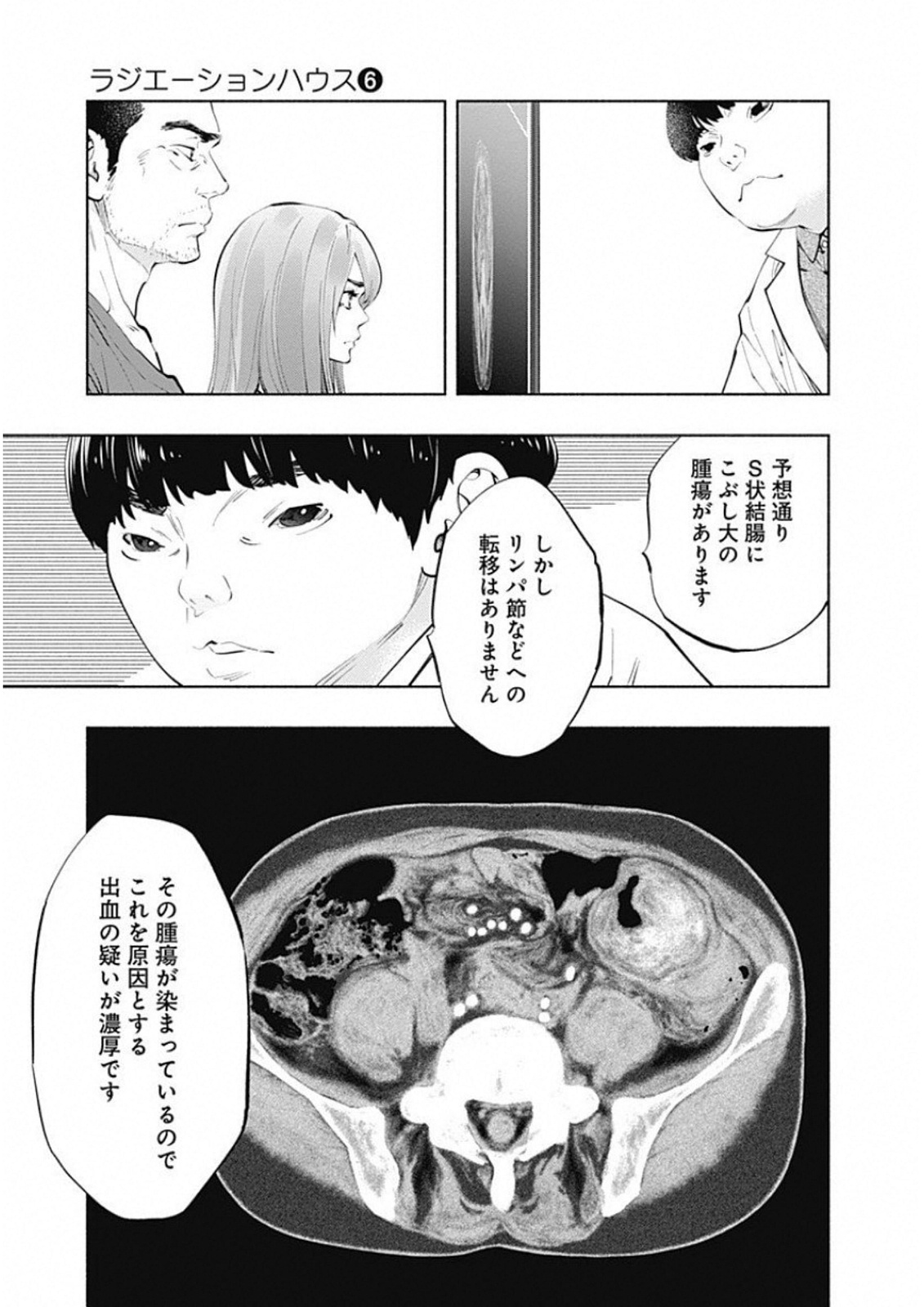 ラジエーションハウス - 第44話 - Page 13