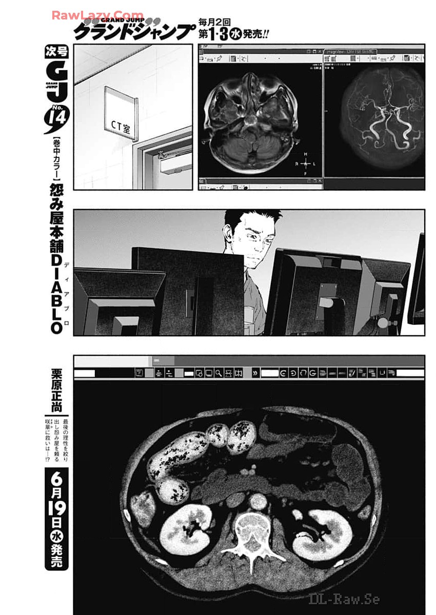 ラジエーションハウス - 第137話 - Page 5